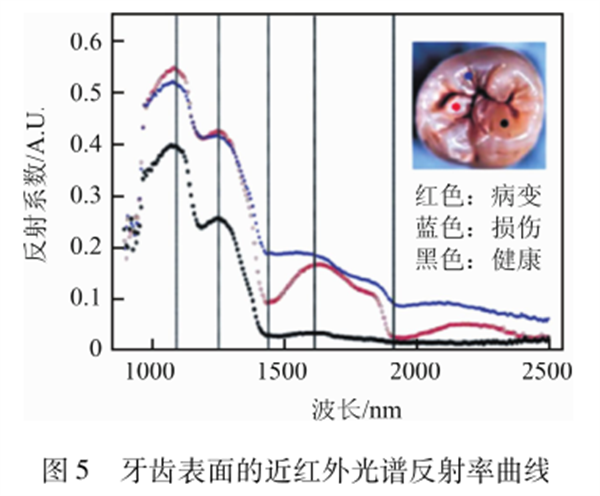圖5 牙齒表面的近紅外光譜反射率曲線
